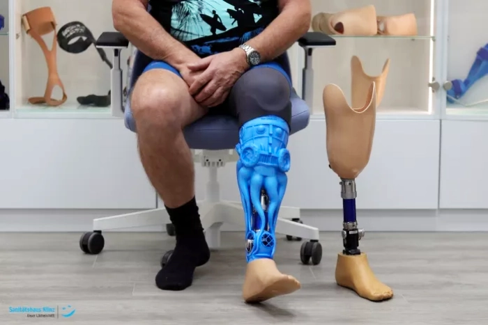 Prostheses