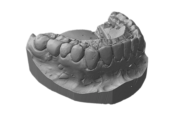 Dental 3d scan